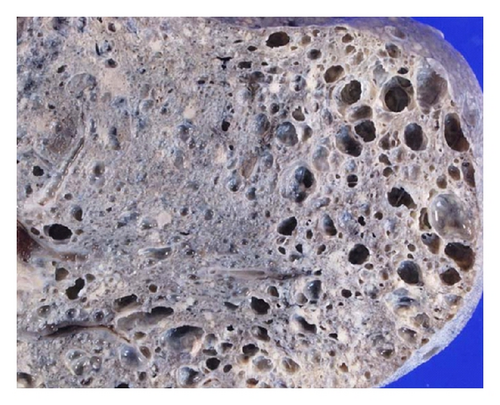 Details are in the caption following the image
