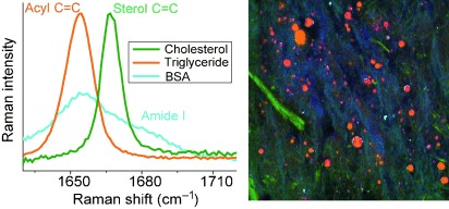 Label-Free Quantitative Imaging of Cholesterol in Intact Tissues by Hyperspectral Stimulated Raman Scattering Microscopy