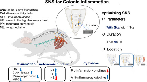 A novel method of sacral nerve stimulation for colonic inflammation