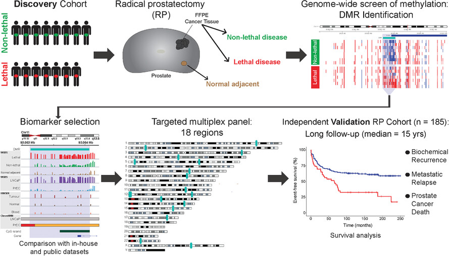 Comprehensive methylome sequencing reveals prognostic epigenetic biomarkers for prostate cancer mortality