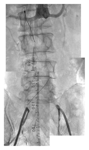Details are in the caption following the image