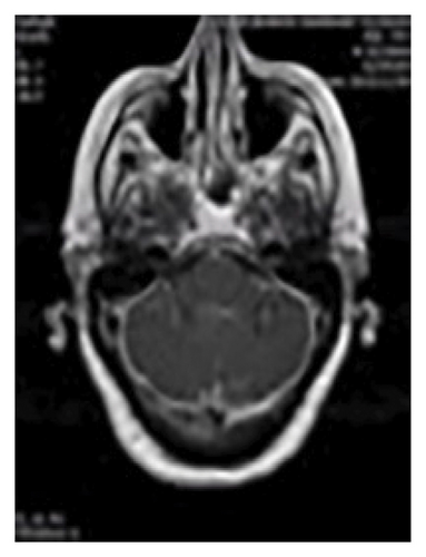 Details are in the caption following the image