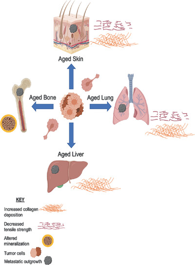 A glitch in the matrix: Age-dependent changes in the extracellular matrix facilitate common sites of metastasis
