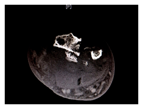 Details are in the caption following the image