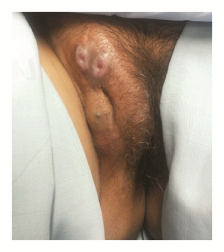 Details are in the caption following the image
