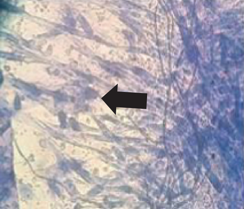 Details are in the caption following the image