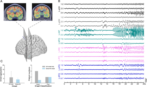 Details are in the caption following the image Details are in the caption following the image