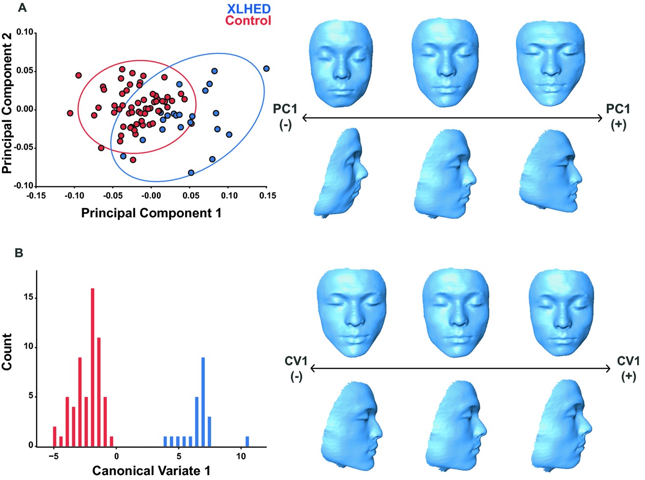Craniofacial morphometric analysis of individuals with X-linked hypohidrotic ectodermal dysplasia