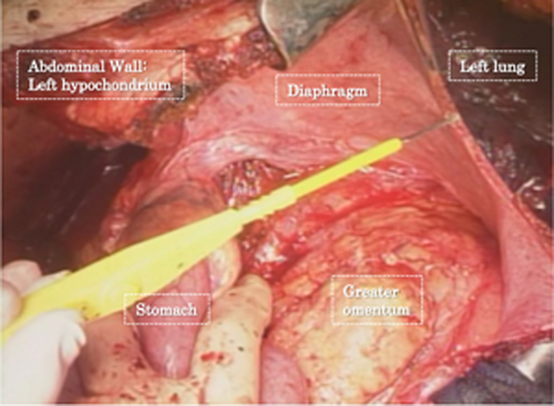 Details are in the caption following the image Details are in the caption following the image