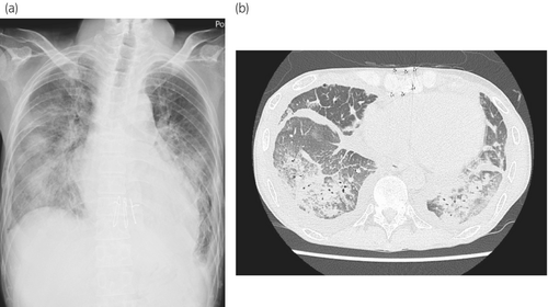 Details are in the caption following the image Details are in the caption following the image
