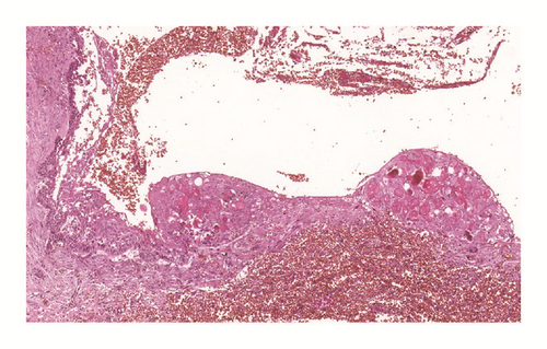 Details are in the caption following the image