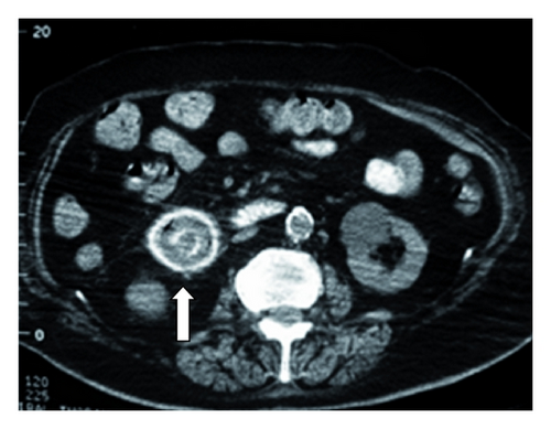 Details are in the caption following the image