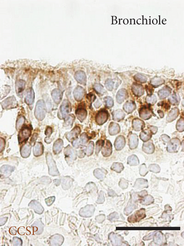 Details are in the caption following the image