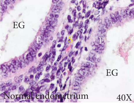 Details are in the caption following the image