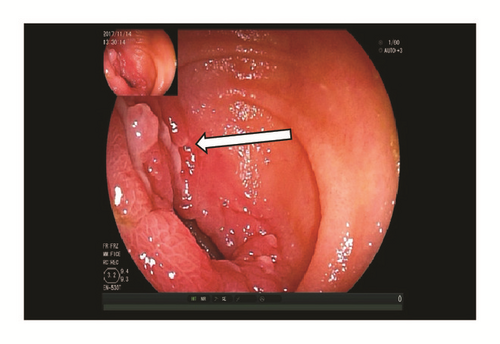 Details are in the caption following the image Details are in the caption following the image