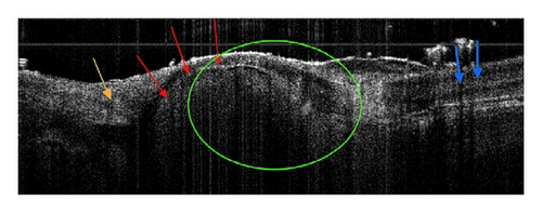 Details are in the caption following the image Details are in the caption following the image