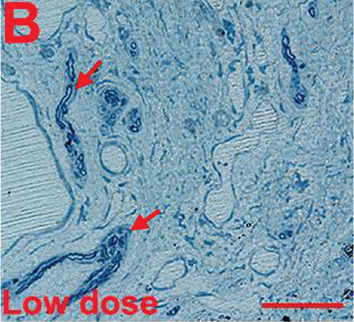 Details are in the caption following the image