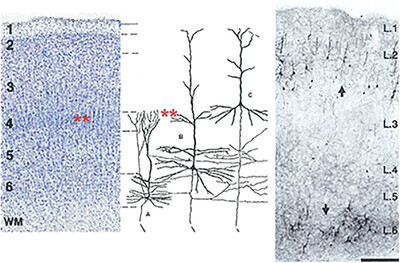 Cellular and laminar architecture: A short history and commentary