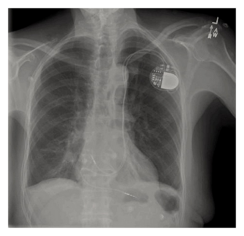 Details are in the caption following the image