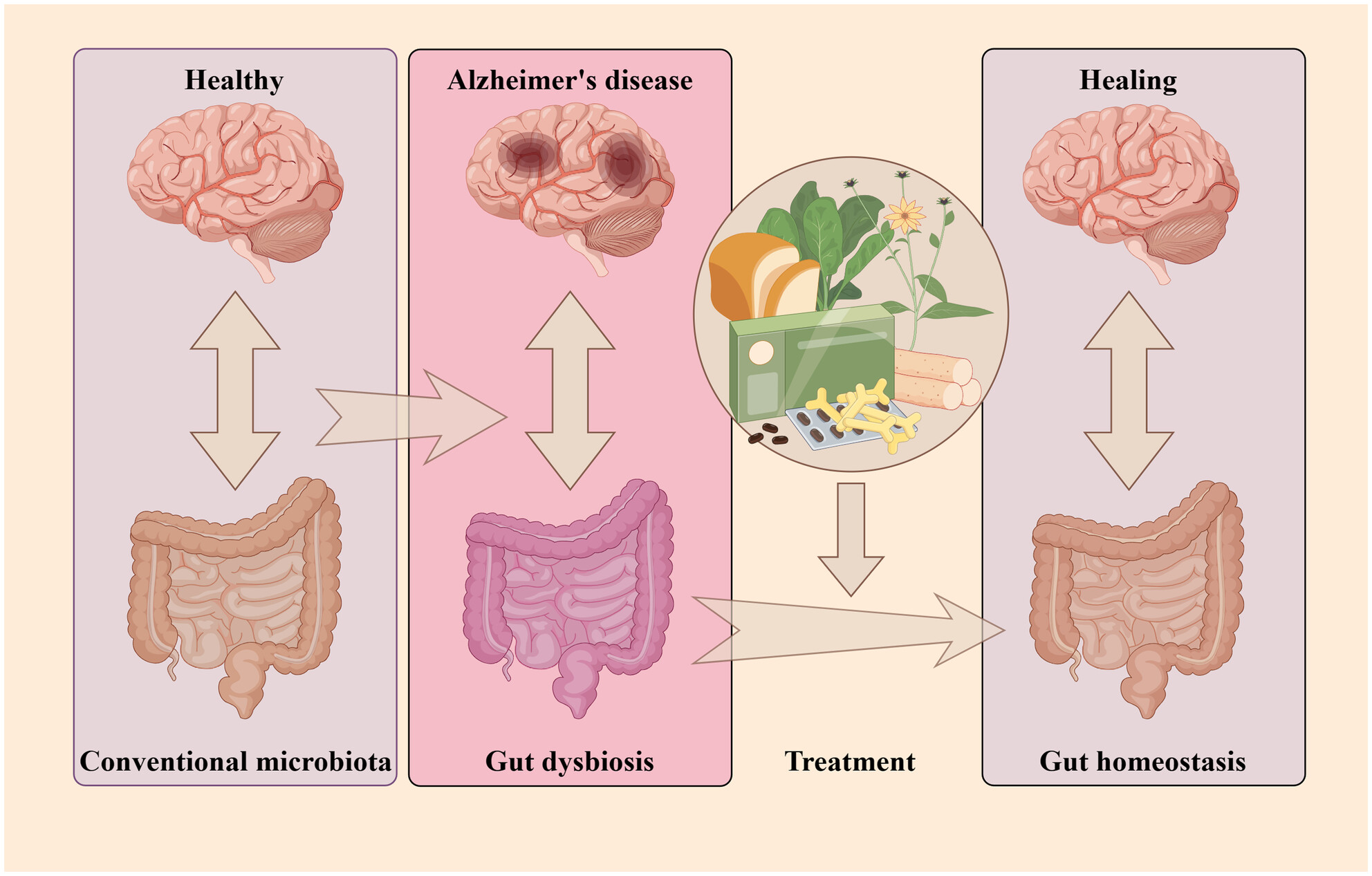 Deciphering the intricate linkage between the gut microbiota and Alzheimer's disease: Elucidating mechanistic pathways promising therapeutic strategies