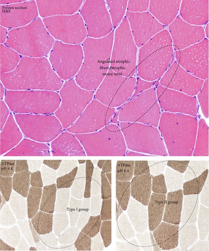 Details are in the caption following the image Details are in the caption following the image