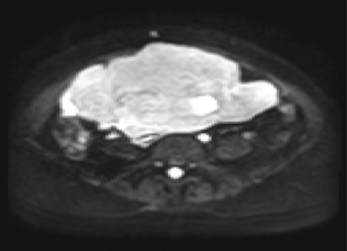 Details are in the caption following the image