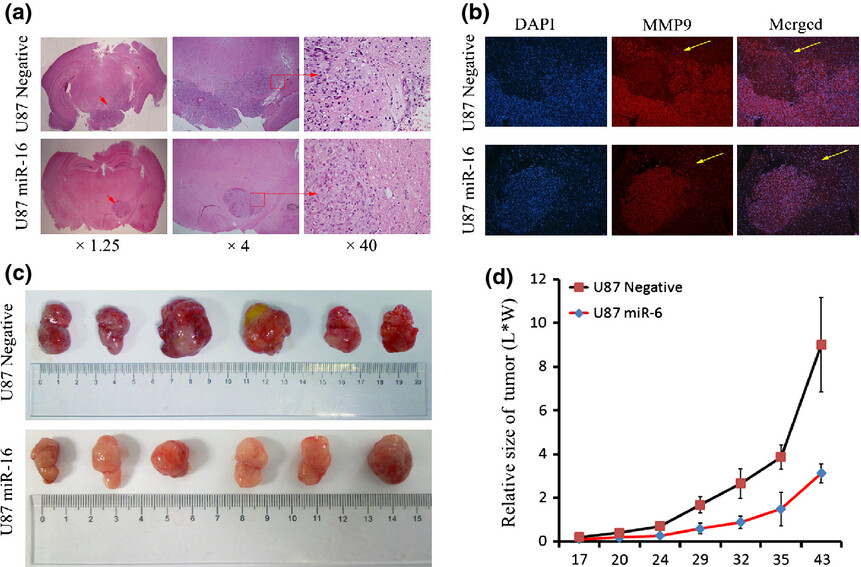RETRACTED: MicroRNA-16 inhibits glioma cell growth and invasion through suppression of BCL2 and the nuclear factor-κB1/MMP9 signaling pathway