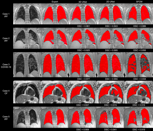 Details are in the caption following the image Details are in the caption following the image