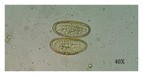 Details are in the caption following the image