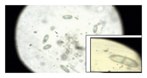 Details are in the caption following the image