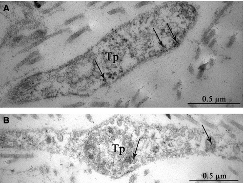 Details are in the caption following the image