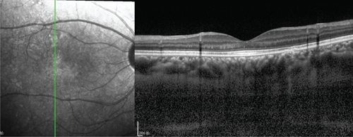 Details are in the caption following the image Details are in the caption following the image