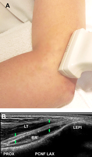 Details are in the caption following the image Details are in the caption following the image