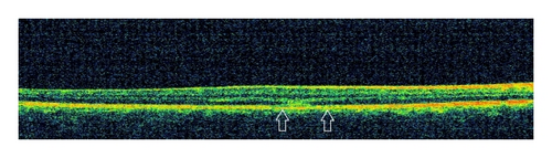 Details are in the caption following the image