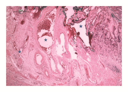 Details are in the caption following the image Details are in the caption following the image