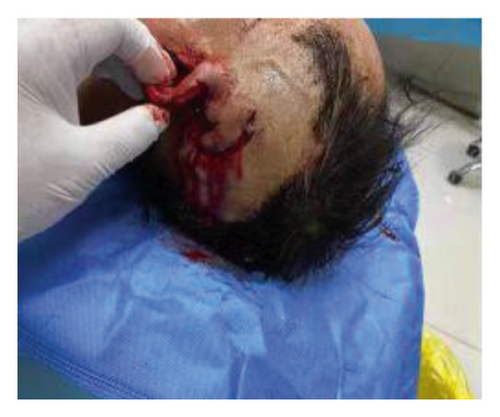 Details are in the caption following the image Details are in the caption following the image
