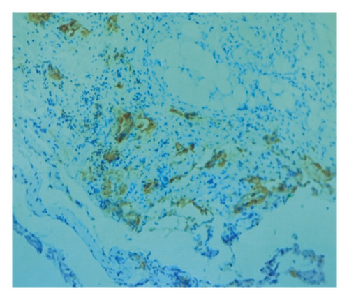 Details are in the caption following the image