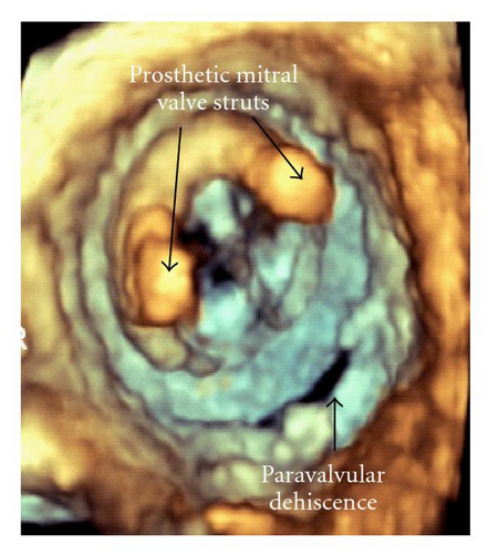 Details are in the caption following the image