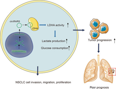 Circular RNA, circular RARS, promotes aerobic glycolysis of non-small-cell lung cancer by binding with LDHA