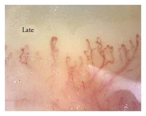 Details are in the caption following the image