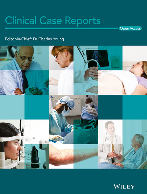 False-positive semiquantitative immunochromatography assays for procalcitonin in three patients with rheumatoid arthritis—A case series