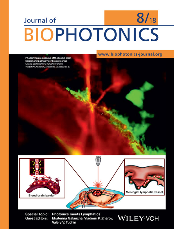 Front Cover: Photodynamic opening of the blood-brain barrier and pathways of brain clearing (J. Biophotonics 8/2018)
