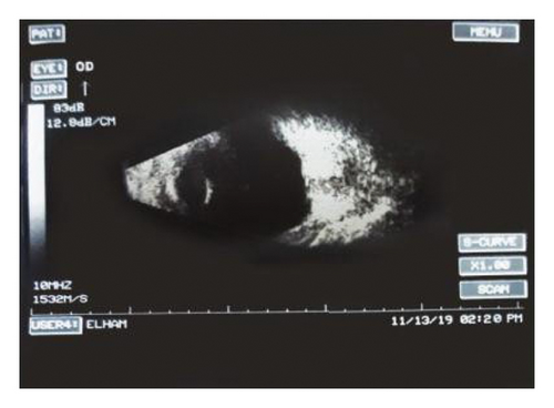 Details are in the caption following the image Details are in the caption following the image