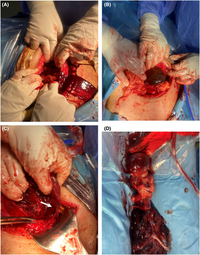 Details are in the caption following the image Details are in the caption following the image