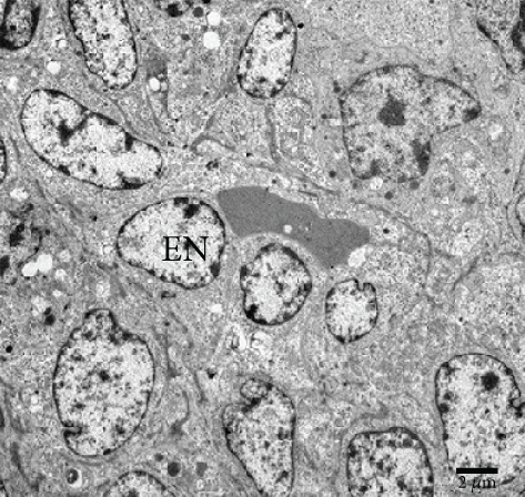 Details are in the caption following the image