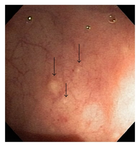 Details are in the caption following the image Details are in the caption following the image