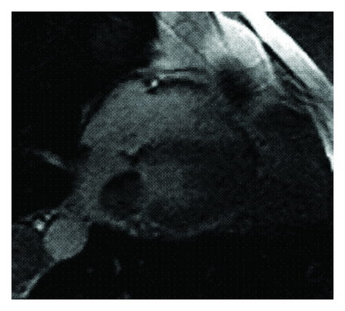 Details are in the caption following the image