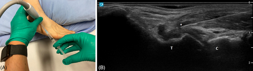 Details are in the caption following the image Details are in the caption following the image