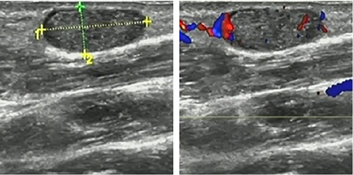 Details are in the caption following the image
