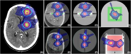 Details are in the caption following the image Details are in the caption following the image